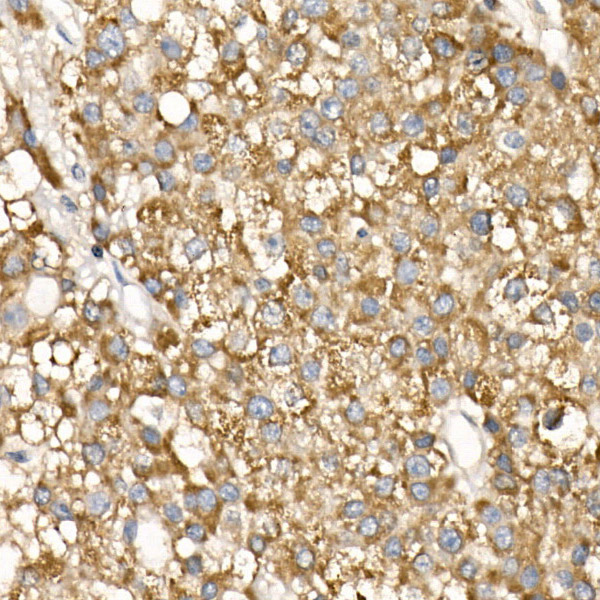COX5B Rabbit Polyclonal Antibody - Image 3