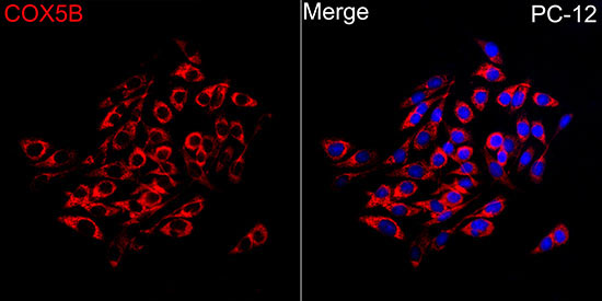 COX5B Rabbit Polyclonal Antibody - Image 6