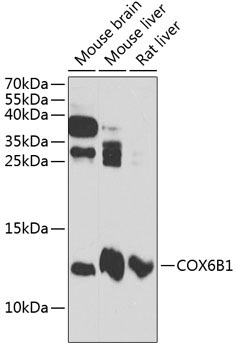 COX6B1 Rabbit Polyclonal Antibody
