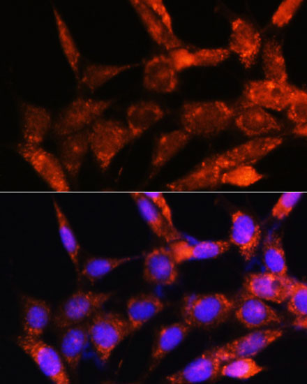 COX6C Rabbit Polyclonal Antibody