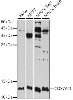 COX7A2L Rabbit Polyclonal Antibody