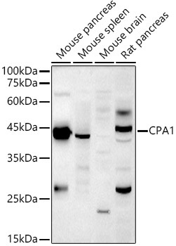 CPA1 Rabbit Polyclonal Antibody