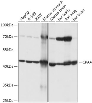 CPA4 Rabbit Polyclonal Antibody