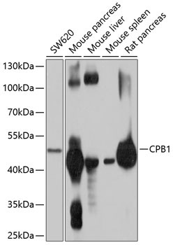 CPB1 Rabbit Polyclonal Antibody