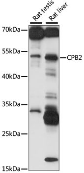 CPB2 Rabbit Polyclonal Antibody