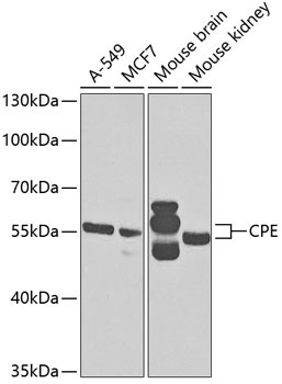 CPE Rabbit Polyclonal Antibody