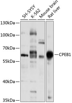 CPEB1 Rabbit Polyclonal Antibody