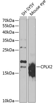 CPLX2 Rabbit Polyclonal Antibody
