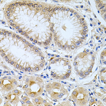 CPM Rabbit Polyclonal Antibody - Image 2