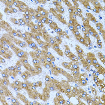 CPM Rabbit Polyclonal Antibody - Image 3