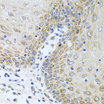 CPM Rabbit Polyclonal Antibody - Image 4