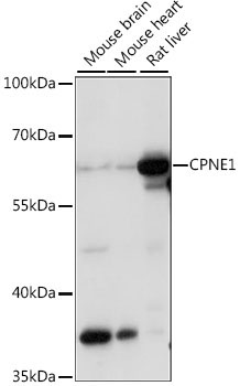 CPNE1 Rabbit Polyclonal Antibody