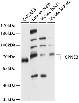 CPNE3 Rabbit Polyclonal Antibody