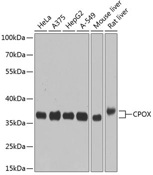 CPOX Rabbit Polyclonal Antibody