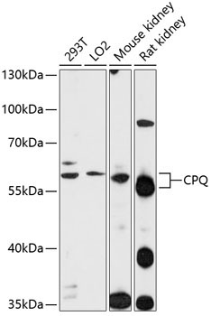 CPQ Rabbit Polyclonal Antibody