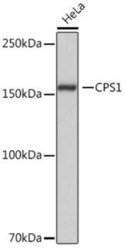 CPS1 Rabbit Monoclonal Antibody