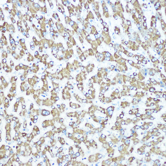 CPS1 Rabbit Monoclonal Antibody - Image 2