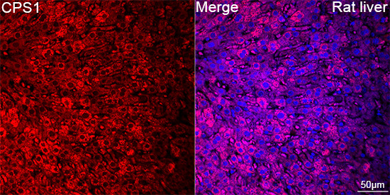 CPS1 Rabbit Monoclonal Antibody - Image 3