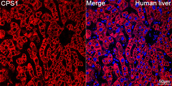 CPS1 Rabbit Monoclonal Antibody - Image 4