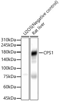 CPS1 Rabbit Polyclonal Antibody
