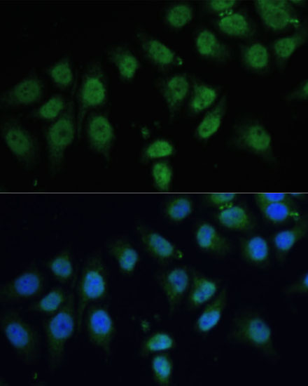 CPS1 Rabbit Polyclonal Antibody - Image 2