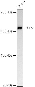 CPS1 Rabbit Polyclonal Antibody