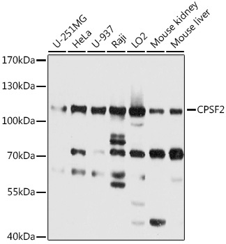 CPSF2 Rabbit Polyclonal Antibody