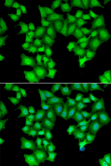 CPSF3L Rabbit Polyclonal Antibody - Image 2