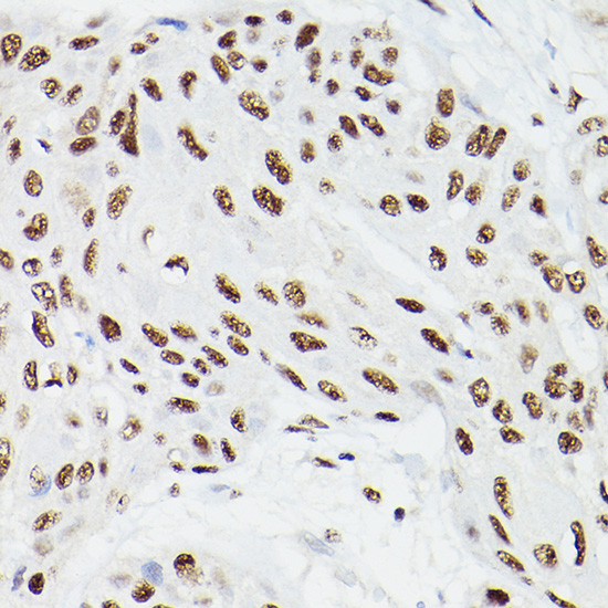 CPSF6 Rabbit Polyclonal Antibody - Image 2