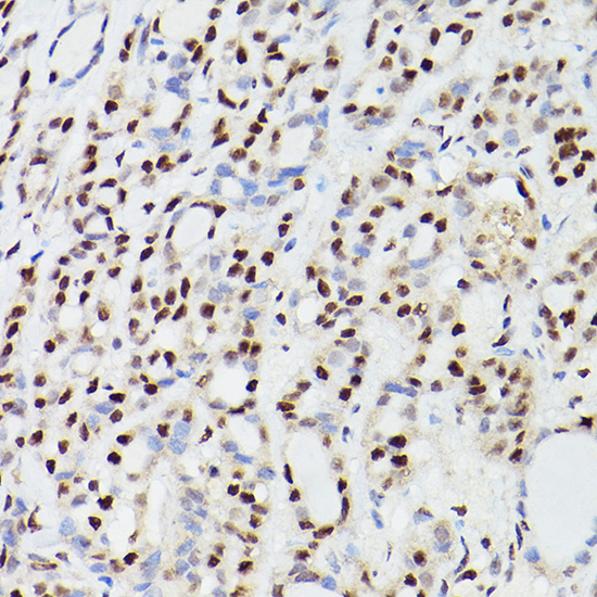 CPSF6 Rabbit Polyclonal Antibody - Image 3