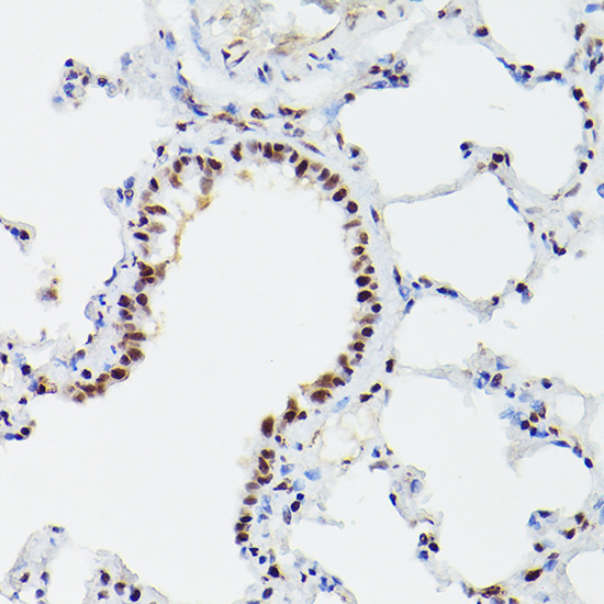 CPSF6 Rabbit Polyclonal Antibody - Image 4