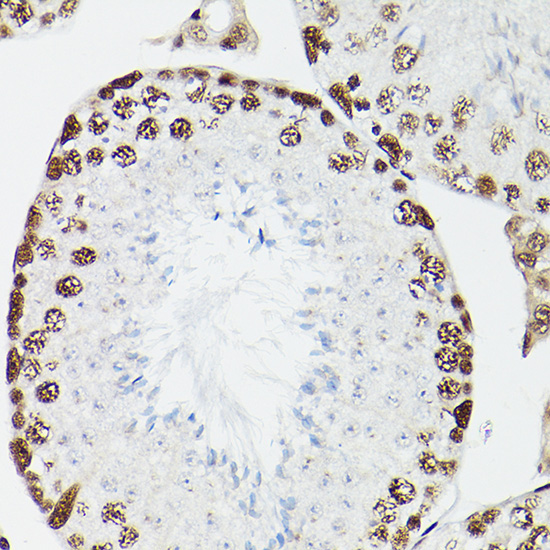 CPSF6 Rabbit Polyclonal Antibody - Image 5