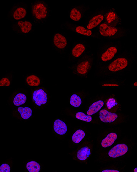 CPSF6 Rabbit Polyclonal Antibody - Image 6