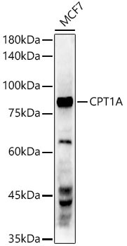CPT1A Rabbit Monoclonal Antibody