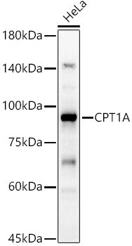 CPT1A Rabbit Polyclonal Antibody