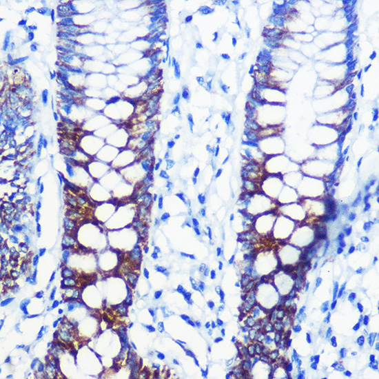 CPT1A Rabbit Polyclonal Antibody - Image 2