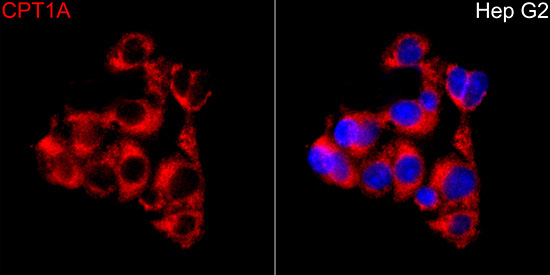 CPT1A Rabbit Polyclonal Antibody - Image 3