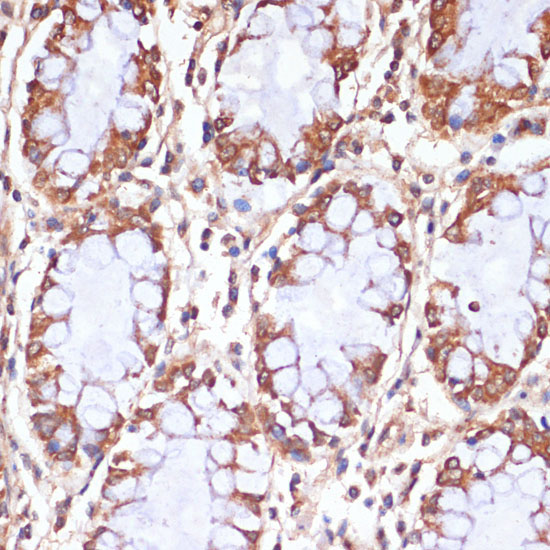 CPT1B Rabbit Polyclonal Antibody - Image 2