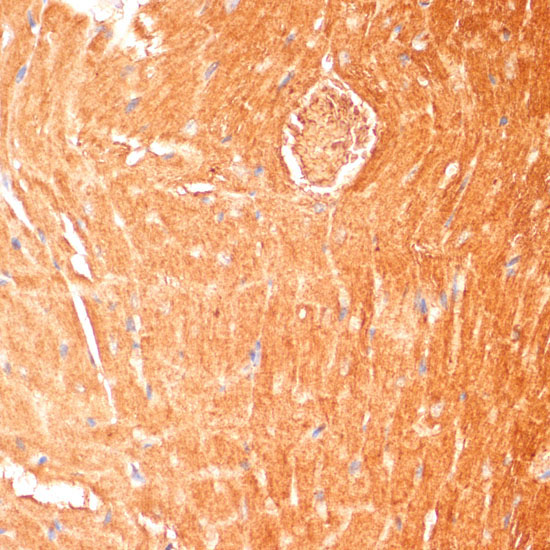 CPT1B Rabbit Polyclonal Antibody - Image 3