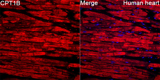 CPT1B Rabbit Polyclonal Antibody - Image 4