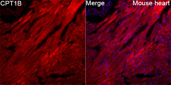 CPT1B Rabbit Polyclonal Antibody - Image 5