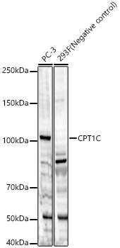 CPT1C Rabbit Polyclonal Antibody