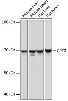 CPT2 Rabbit Monoclonal Antibody