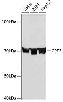 CPT2 Rabbit Monoclonal Antibody - Image 2