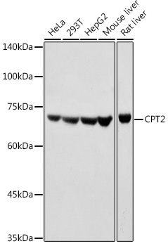 CPT2 Rabbit Polyclonal Antibody
