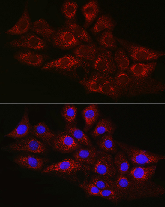 CPT2 Rabbit Polyclonal Antibody - Image 2