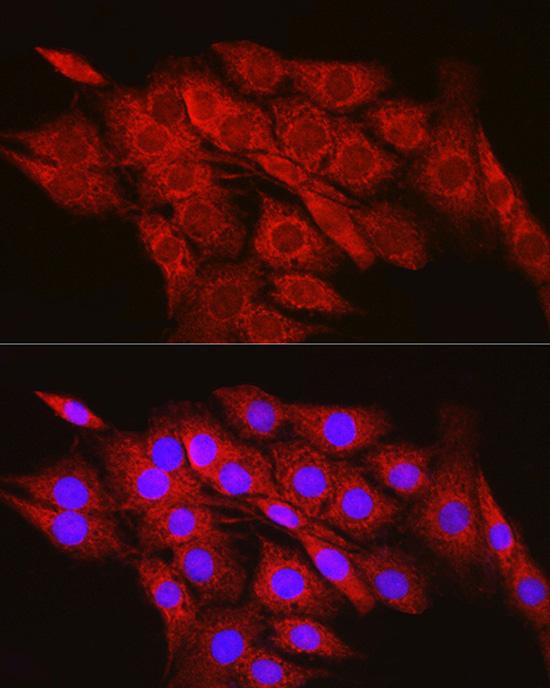CPT2 Rabbit Polyclonal Antibody - Image 3