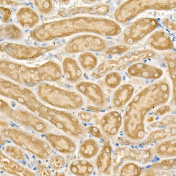 CPT2 Rabbit Polyclonal Antibody - Image 2