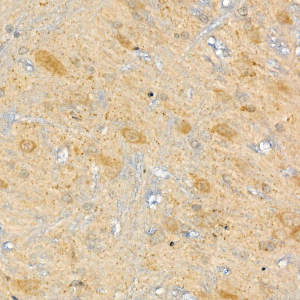 CPT2 Rabbit Polyclonal Antibody - Image 3