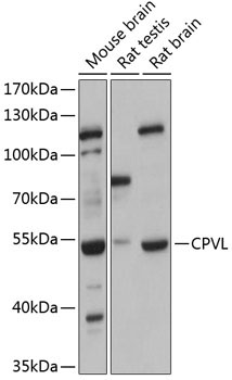 CPVL Rabbit Polyclonal Antibody